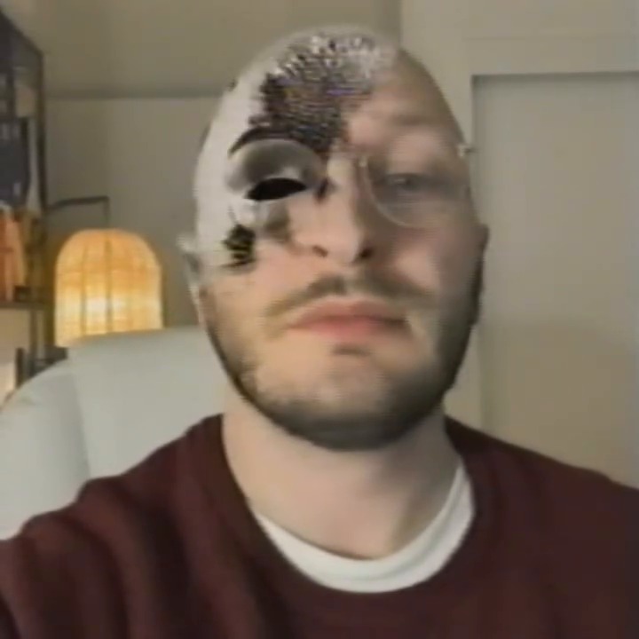 The pin surface has spread down the left side of his face.